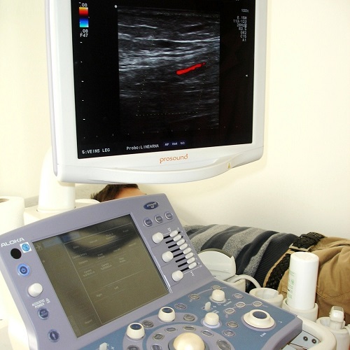 Ultrazvuk-i-dopler2
